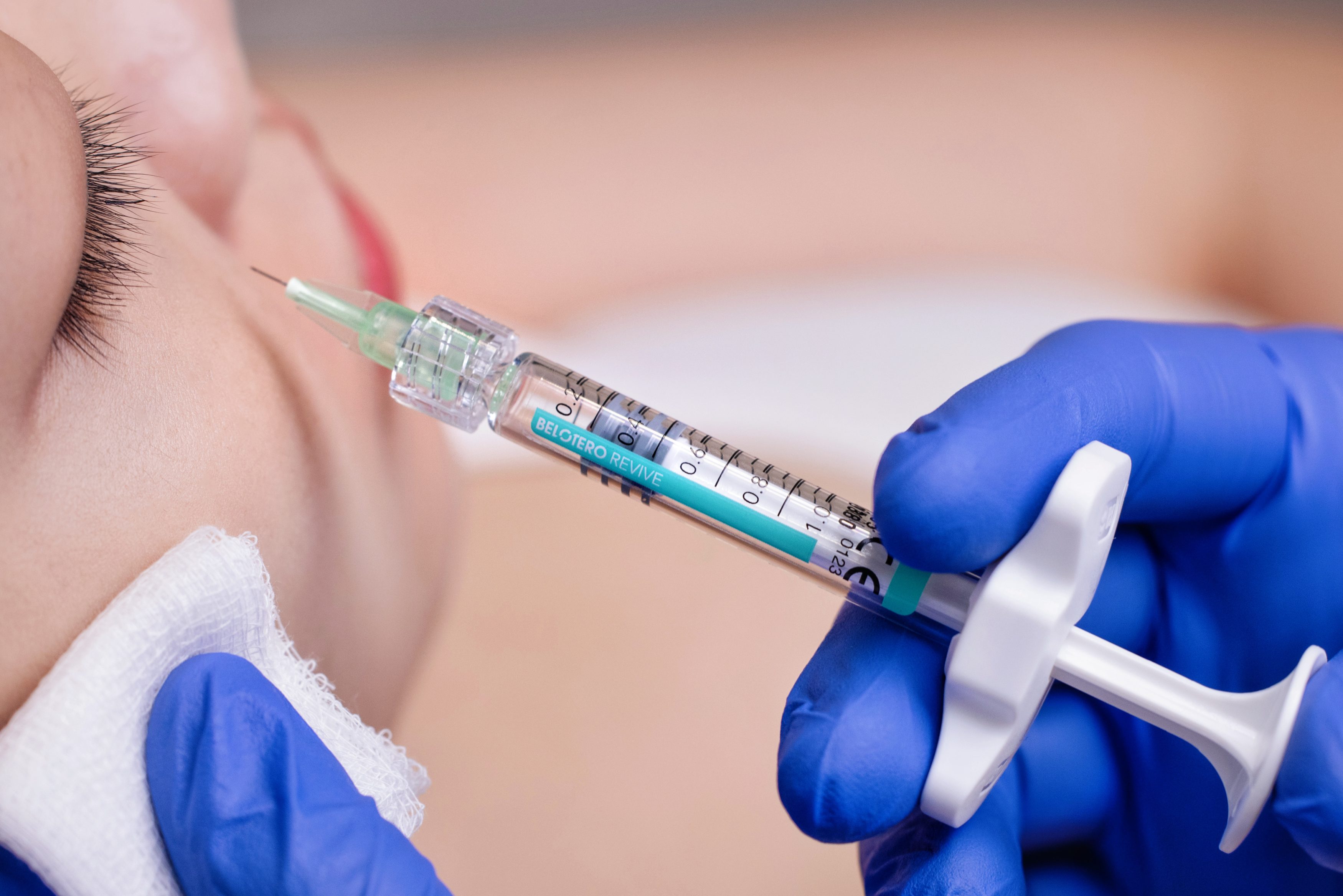Procedure