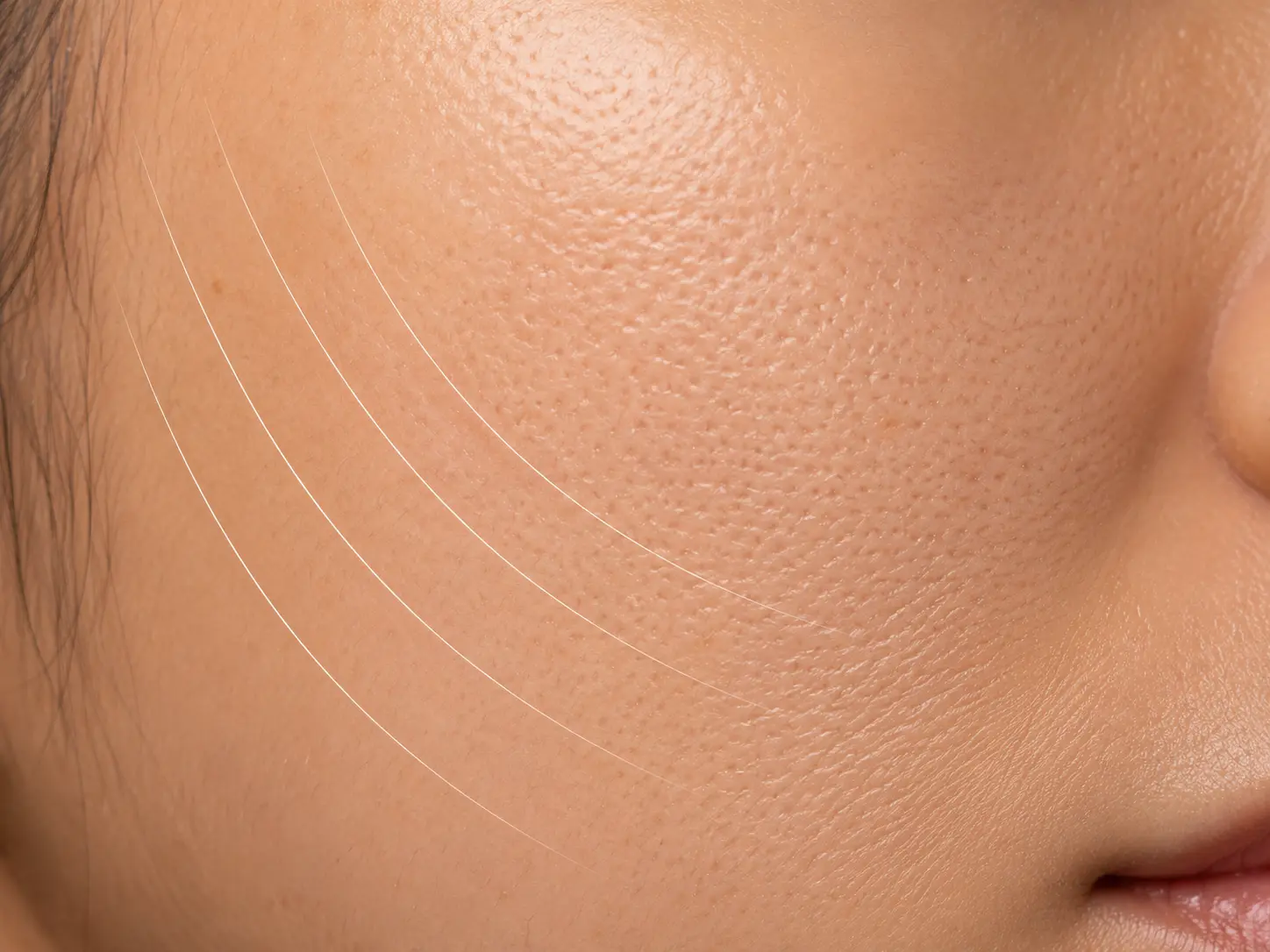 Texture Refinement