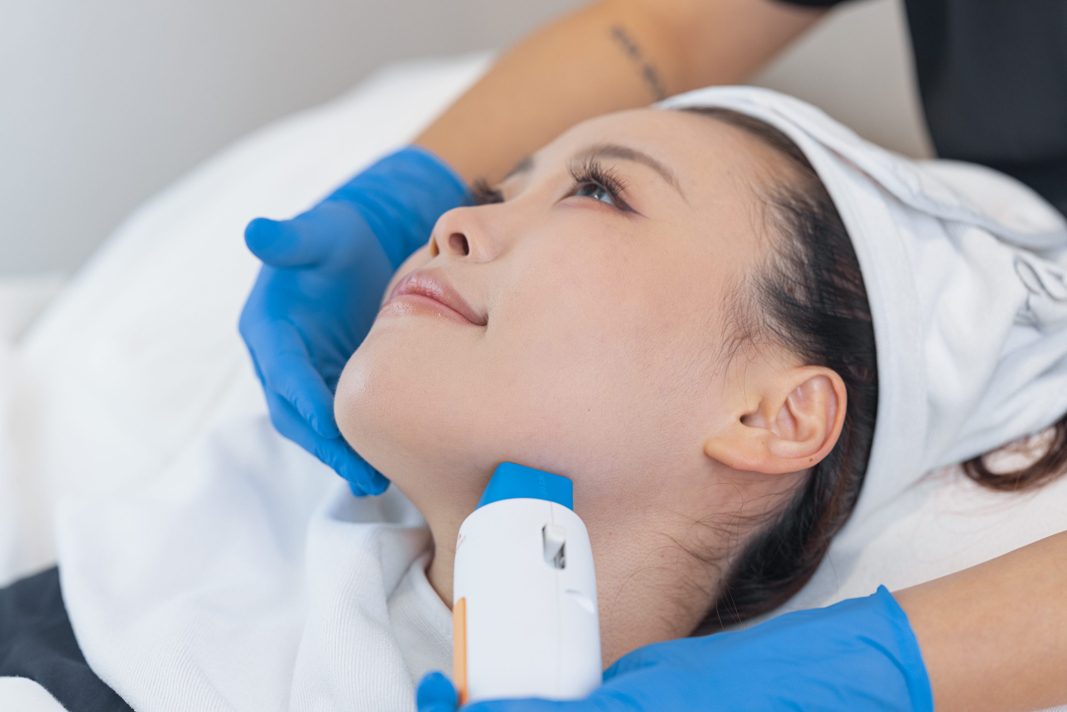 The Monopolar RF Treatment Procedure